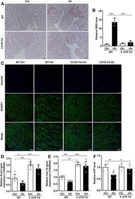 Ckip-1 3′-UTR Attenuates Simulated Microgravity-Induced Cardiac Atrophy